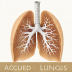 AccuMed Anatomy Lungs Model