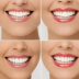 Brightly Whitening Strips