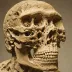 Homo luzonensis (CCH6)