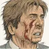 Massive Head Wound Harry