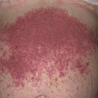 The Ordinary Niacinamide 10% + Zinc 1%